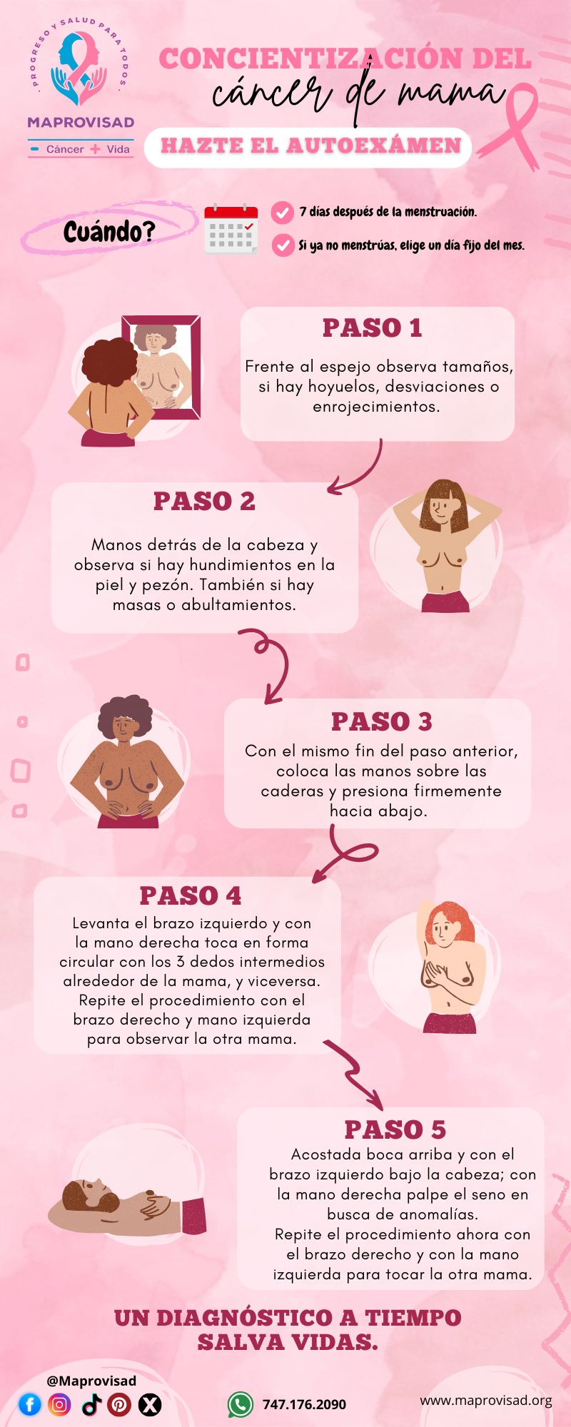 Autoexploración mamaria