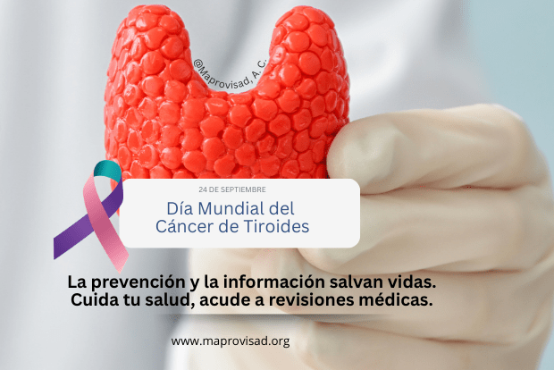Cancer de Tiroides